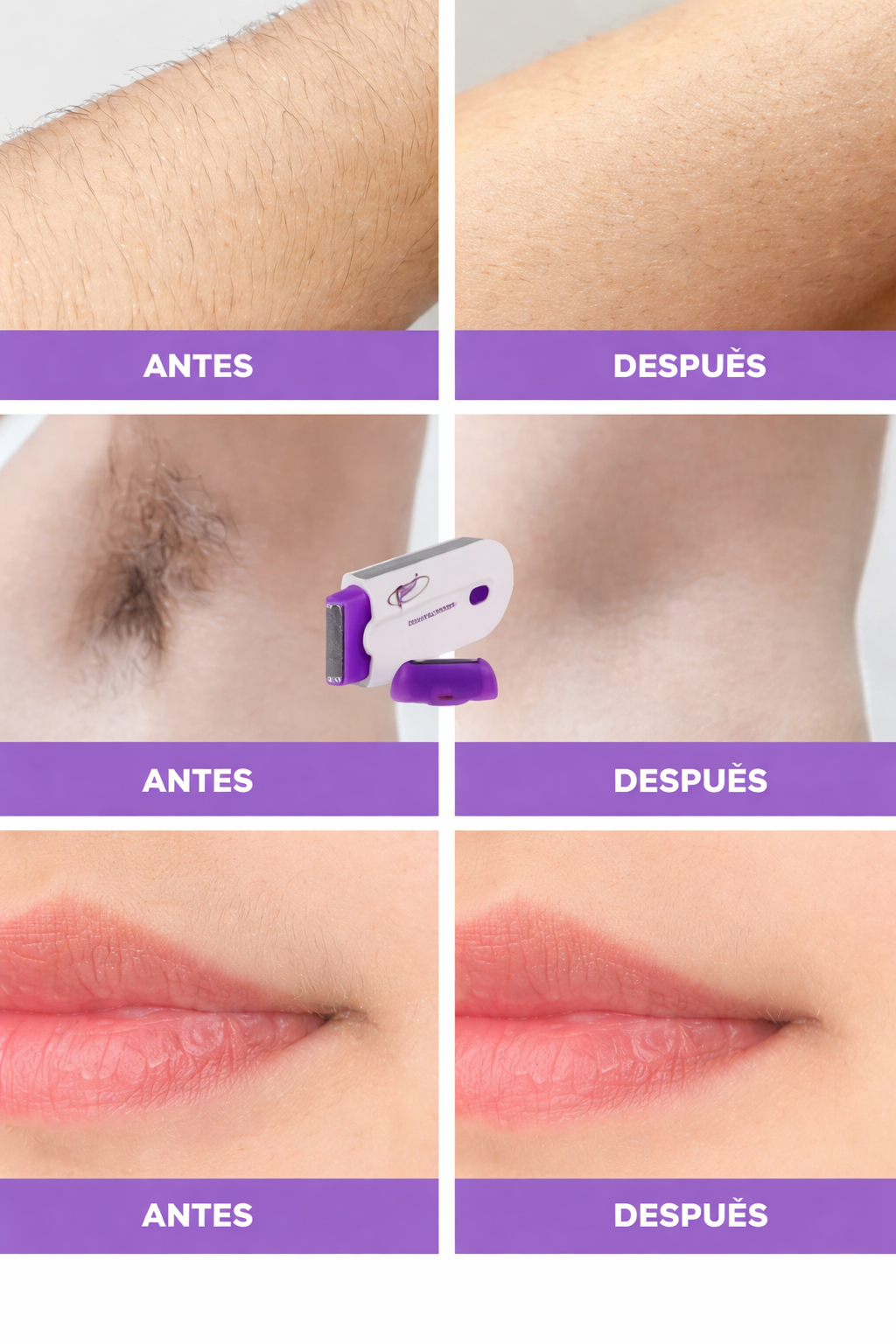 Depiladora Eléctrica + Crema Gratis y E-book Como Regalo Especial!